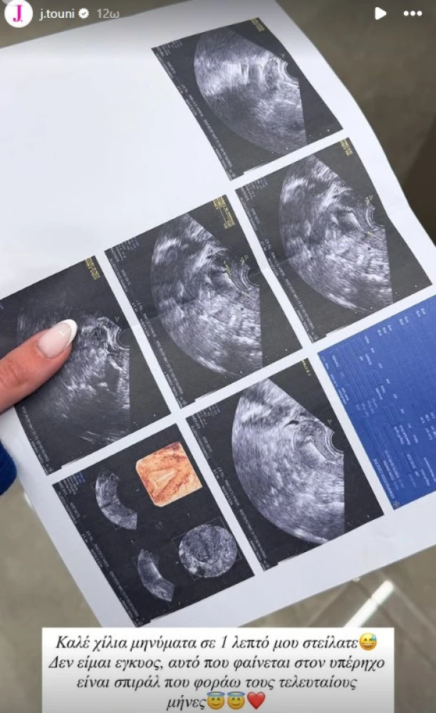 φωτογραφία instagram