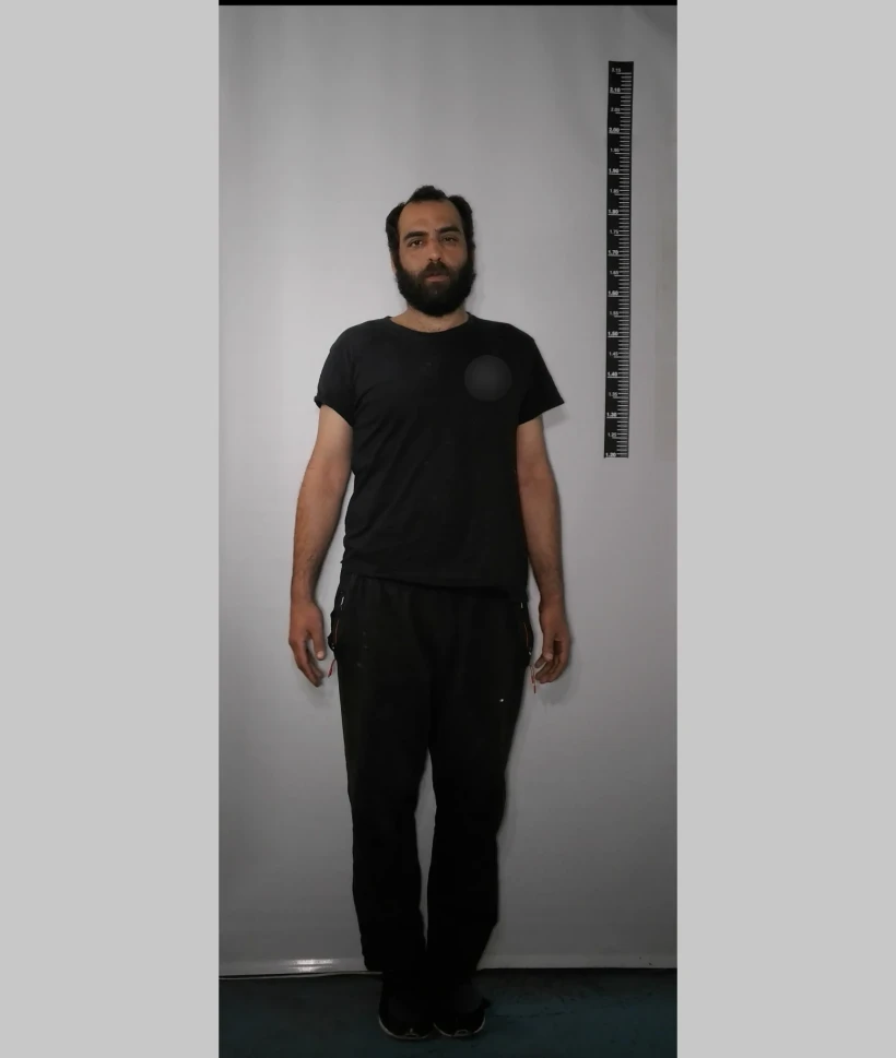 chantzidis-3-1.webp?v=0