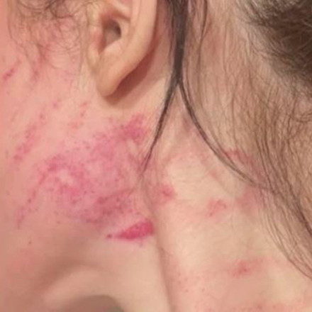 Ενδοοικογενειακή βία: Ζήτησε από το σύντροφό της να χωρίσουν και την κακοποιεί συνεχώς