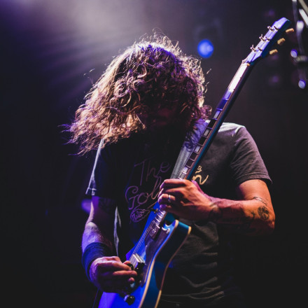 Οι μουσικοί δεν βιώνουν πόνο όπως οι υπόλοιποι άνθρωποι - Αποκαλυπτική έρευνα εξηγεί τον λόγο