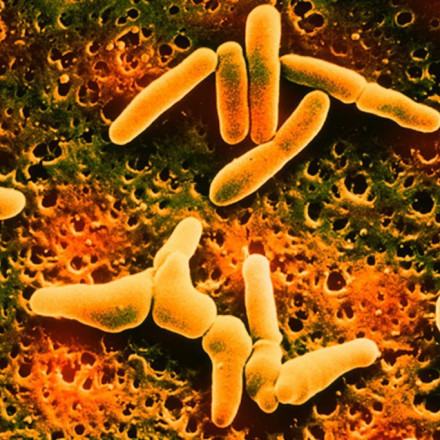 Θανατηφόρος λιστέρια σε ζυμαρικά: 6 νεκροί και δεκάδες ασθενείς στις ΗΠΑ - Ανακλήθηκαν προϊόντα