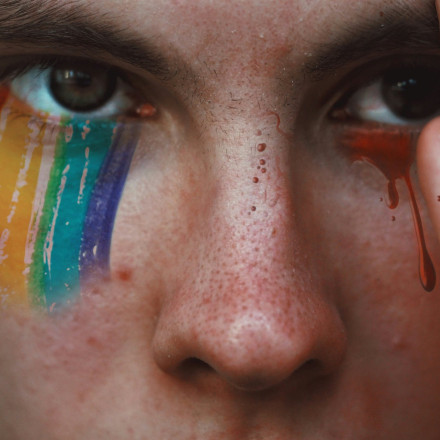 Θεσσαλονίκη: Καταγγελία για ομοφοβική επίθεση - «Πιαστήκαμε αγκαλιά στον δρόμο και μας πέταξαν νερά»