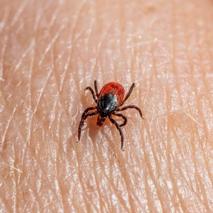 Πρώτη φορά στα χρονικά: Πέθανε από αλλεργία στο κόκκινο κρέας - Την προκάλεσε δάγκωμα τσιμπουριού