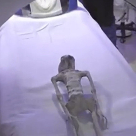 Εξωγήινοι Μεξικό: Τους πέρασαν από αξονική τομογραφία – Τί έδειξε η εξέταση