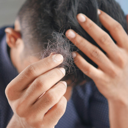 Ο πρόεδρος της Νότιας Κορέας «τα βάζει» με τη... φαλάκρα - Δημόσια κάλυψη για απώλεια μαλλιών