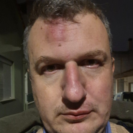 Άγριος ξυλοδαρμός εκδότη έξω από το σπίτι του στον Βόλο