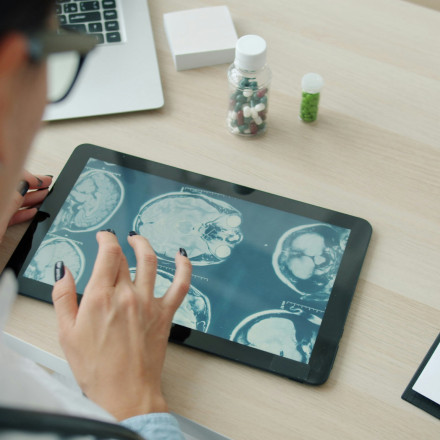 Νέο σύστημα ΑΙ διαγιγνώσκει εγκεφαλικές παθήσεις σε δευτερόλεπτα