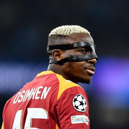 Συγκλονιστικές δηλώσεις Όσιμεν: «Στη Νάπολι μου φέρθηκαν σαν σκυλί – Δεν είμαι μαριονέτα κανενός»