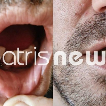 «Με χτυπούσαν επί 15 λεπτά»: Άγριο σκηνικό σε κρατητήρια στην Ηλεία - Άνδρας με κατάγματα στη γνάθο