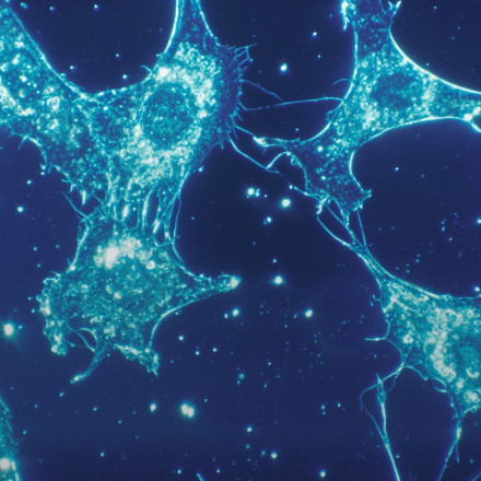 «Η Βιολογία στις Τέχνες» -Έκθεση έργων από τον χώρο των βιολογικών επιστημών