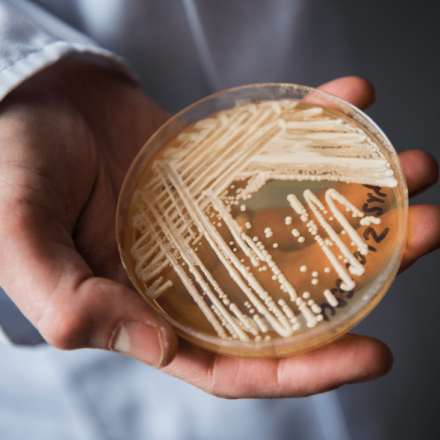 Candida Auris Νίκος Σύψας: Έχουμε πρόβλημα στα νοσοκομεία της Αττικής