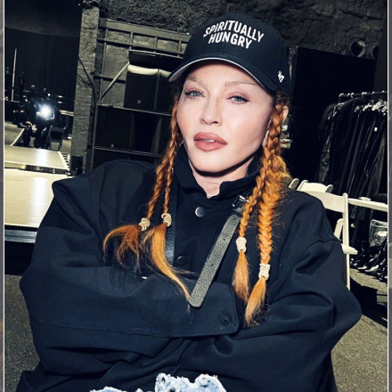Madonna: Τρολάρει τον εαυτό της για τις πλαστικές επεμβάσεις - «Κοιτάξτε πόσο χαριτωμένη είμαι μετά το χειρουργείο»