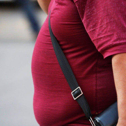 Παγκόσμια Ημέρα Παχυσαρκίας: Χρόνια νόσος με διαστάσεις επιδημίας