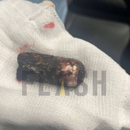 Συγκλονιστικό ντοκουμέντο: Ο Γιώργος εκλιπαρούσε να του βγάλουμε τη φωτοβολίδα