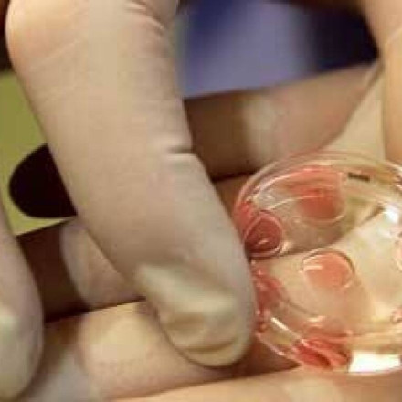 Ωάρια από αρσενικά κύτταρα: Ανοίγει ο δρόμος για μωρά με δύο βιολογικούς πατέρες