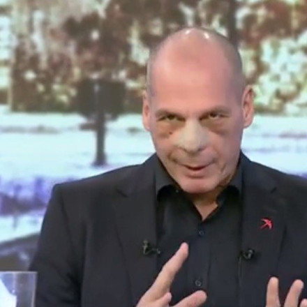 Επίθεση στον Γιάνη Βαρουφάκη: Ελεύθερος με περιοριστικούς όρους ο 17χρονος