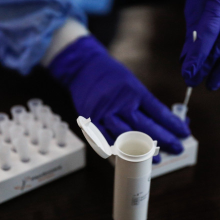 Παρβοϊός: Τι είναι και πώς μεταδίδεται - Ειδικοί απαντούν σε όλα τα ερωτήματα