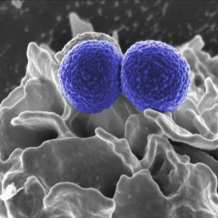 SOS για σταφυλόκοκκο: Πώς μολύνει τα τρόφιμα - Ποιοι οι κίνδυνοι για τα παιδιά