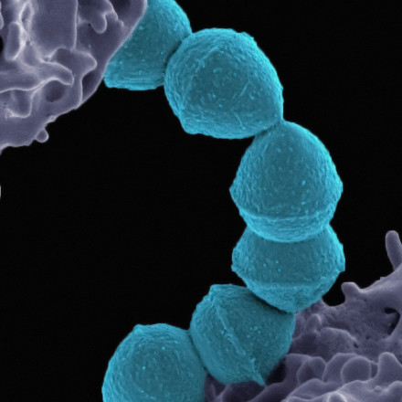 Τι είναι ο στρεπτόκοκκος και πώς μεταδίδεται