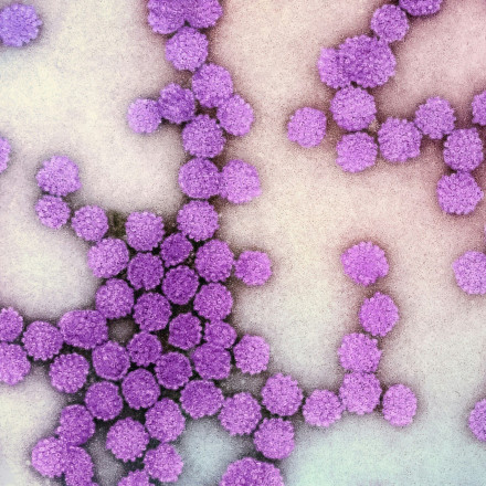 Πώς 750.000 θάνατοι λόγω μικροβιακής αντοχής θα ανατρέπονταν κάθε χρόνο