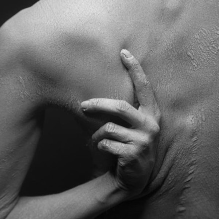 Τι είναι ο Λύκος - Ποια τα συμπτώματα, πώς αντιμετωπίζεται