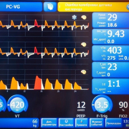 Δραματικός επίλογος στις προσπάθειες νεαρής να επαναφέρει 85χρονο που κατέρρευσε