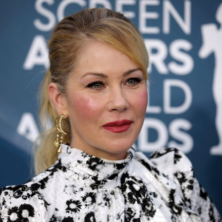 Κριστίνα Άπλγκεϊτ: Αποκαλύπτει τη μόνη πλαστική επέμβαση που έκανε και εξηγεί ποιος την ανάγκασε