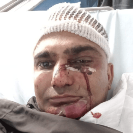 «Βρώμικε Πακιστανέ φύγε από τη χώρα!»: Άγριο ξύλο σε ντελιβερά στα Σεπόλια - Σοκάρει η μαρτυρία του «Βρώμικε Πακιστανέ φύγε από τη χώρα!»: Άγριο ξύλο σε ντελιβερά στα Σεπόλια - Σοκάρει η μαρτυρία του