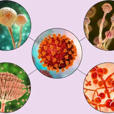 Νεκρός άνδρας από μύκητα Candida Auris στο Μιλάνο – Είχε ταξιδέψει από την Ελλάδα