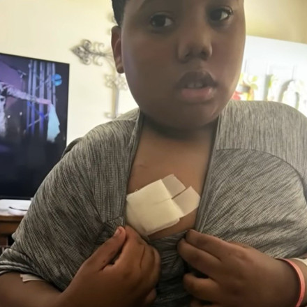 ΗΠΑ: Αστυνομικός πυροβόλησε 11χρονο που είχε καλέσει τις Αρχές για να προστατέψει τη μητέρα του [vid]