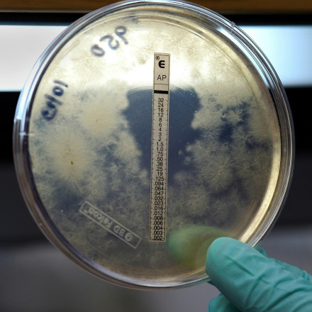 Βγήκε από τη ΜΕΘ η γιατρός που είχε προσβληθεί από μηνιγγίτιδα - «Ξεπέρασε τον κίνδυνο»