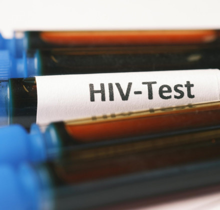 Science: Επίτευγμα της χρονιάς το φάρμακο για τον HIV-AIDS - Τι έδειξαν οι πρώτες δοκιμές Science: Επίτευγμα της χρονιάς το φάρμακο για τον HIV-AIDS - Τι έδειξαν οι πρώτες δοκιμές