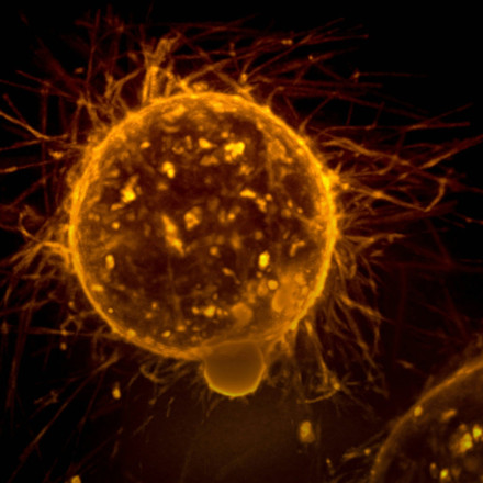 Καρκίνος του εντέρου: Ανακαλύφθηκε πρωτεΐνη που αναγεννά το έντερο αποτρέποντας τους όγκους