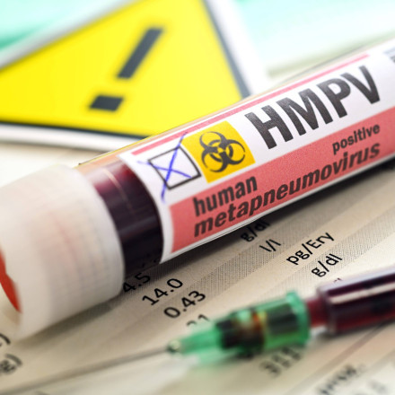 Θεσσαλονίκη: Και δεύτερο κρούσμα του ιού HMPV - Θετική η σύζυγος του 71χρονου