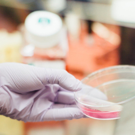 Ημαθία: Θετικά στον στρεπτόκοκκο 7 παιδιά στη Νάουσα - Μόνο 2 με συμπτώματα - Έγιναν 45 τεστ