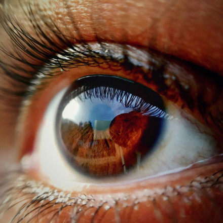 Ο αμφιβληστροειδής μπορεί να προβλέψει τον κίνδυνο εγκεφαλικού επεισοδίου