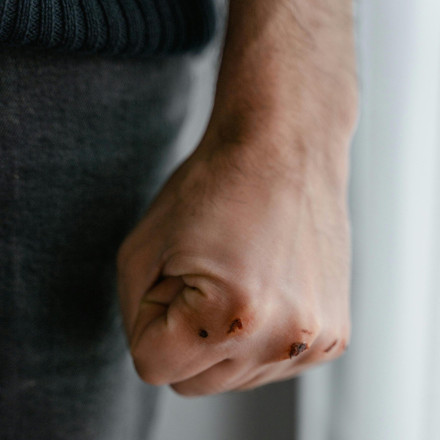 Καθηγητής ξυλοκοπήθηκε από αδερφό 14χρονου μαθητή, τον οποίο είχε χτυπήσει ο ανήλικος γιος του