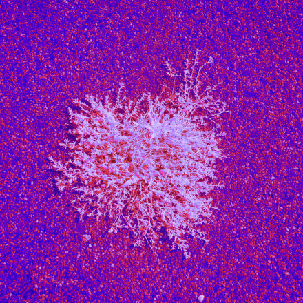 Παγκόσμιος συναγερμός: Ξεχασμένες επιδημίες επιστρέφουν και απειλούν - SOS για εμβολιασμούς