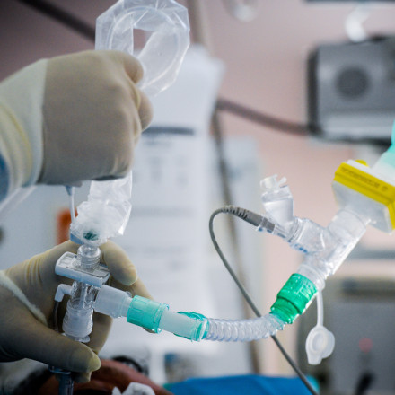 Οι τουρκικές αρχές ερευνούν θάνατο Βραζιλιάνας influencer που «έσβησε» μετά από λιποαναρρόφηση