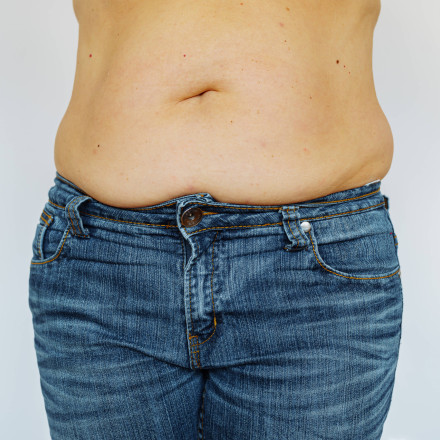 Νέο φάρμακο καίει λίπος χωρίς μυϊκή απώλεια – Ελπίδα για εκατομμύρια παχύσαρκους