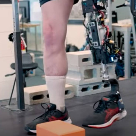 Ερευνητές του ΜΙΤ κατασκεύασαν βιονικό γόνατο που ενσωματώνεται στο σώμα σαν αληθινό άκρο