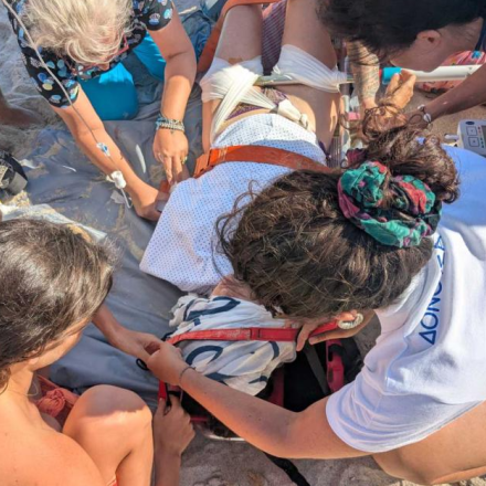 Σοκαριστικό ατύχημα στη Δονούσα: Ομπρέλα καρφώθηκε στον μηρό λουόμενης - Περιπέτεια με τη μεταφορά της