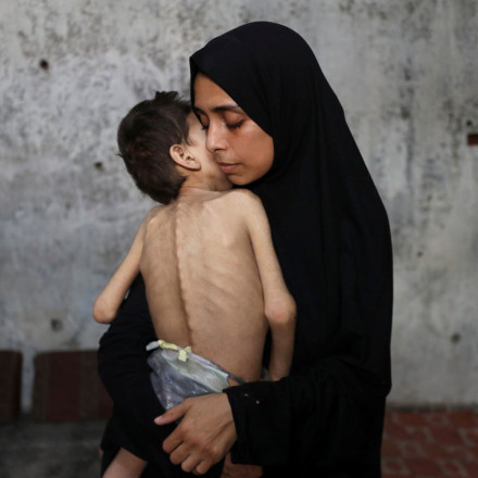 Ισραηλινές ΜΚΟ εκτιμούν για πρώτη φορά ότι το Ισραήλ διαπράττει γενοκτονία στη Γάζα