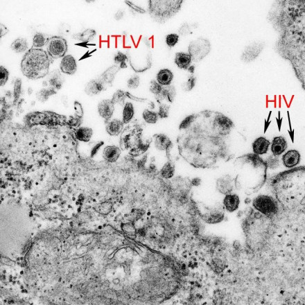 HTLV-1: Βρέθηκε θεραπεία για τον πιο θανατηφόρο ιό που δεν ξέρεις