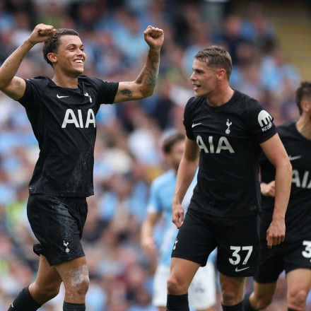 Η Τότεναμ φροντίζει τα… μαλλιά της: Συνεργασία με κορυφαία κλινική μεταμόσχευσης