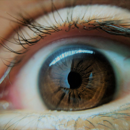 Γλαύκωμα: Νέα μέθοδος έγκαιρης διάγνωσης και θεραπείας υπόσχεται οριστική λύση για την πάθηση