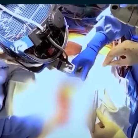 Μεταμόσχευση πνεύμονα από γουρούνι σε άνθρωπο: λειτούργησε για εννέα ημέρες