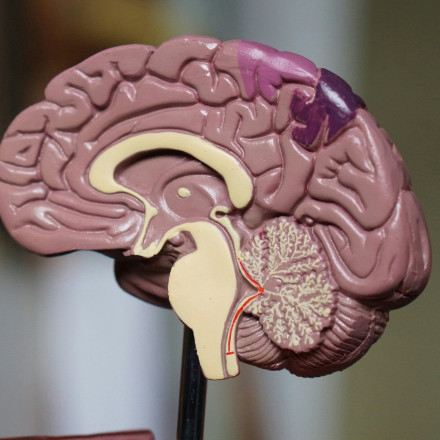 Νέα μέθοδος ανίχνευσης Αλτσχάιμερ: Ακριβής, ανώδυνη και γρήγορη διάγνωση