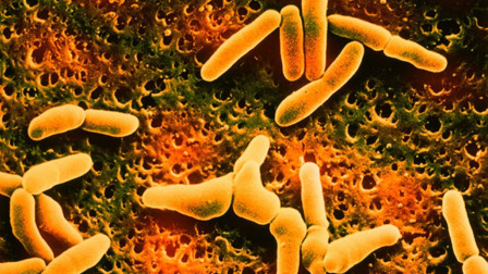 Θανατηφόρος λιστέρια σε ζυμαρικά: 6 νεκροί και δεκάδες ασθενείς στις ΗΠΑ - Ανακλήθηκαν προϊόντα