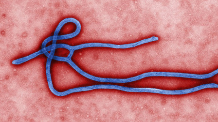 Έμπολα: Γιατί είναι τόσο θανατηφόρος και πώς αντιμετωπίζεται